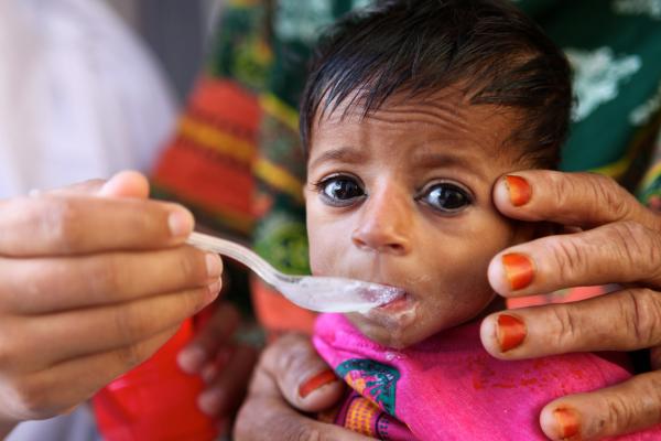 New study reveals nutritional status of under-five in India - Food News